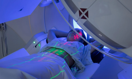 Was sind die Nebenwirkungen der Strahlentherapie bei Prostatakrebs?