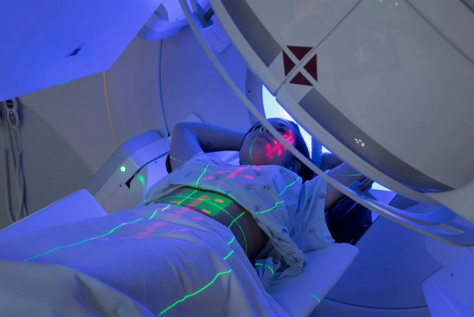 Was sind die Nebenwirkungen der Strahlentherapie bei Prostatakrebs?